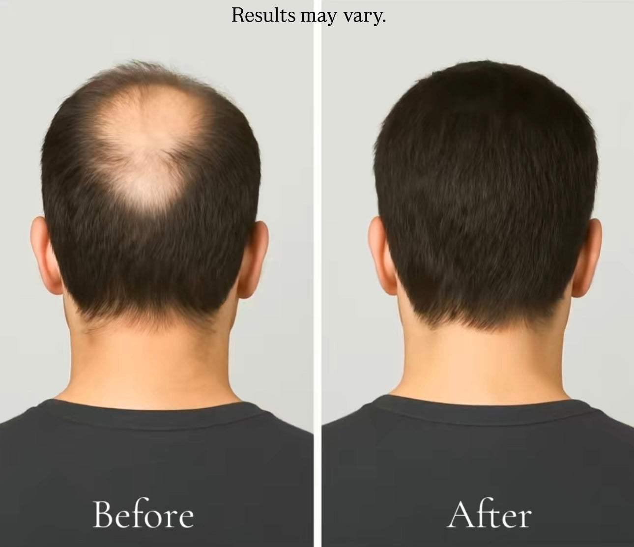 Suero para el crecimiento del cabello con romero y menta Majestic Mane